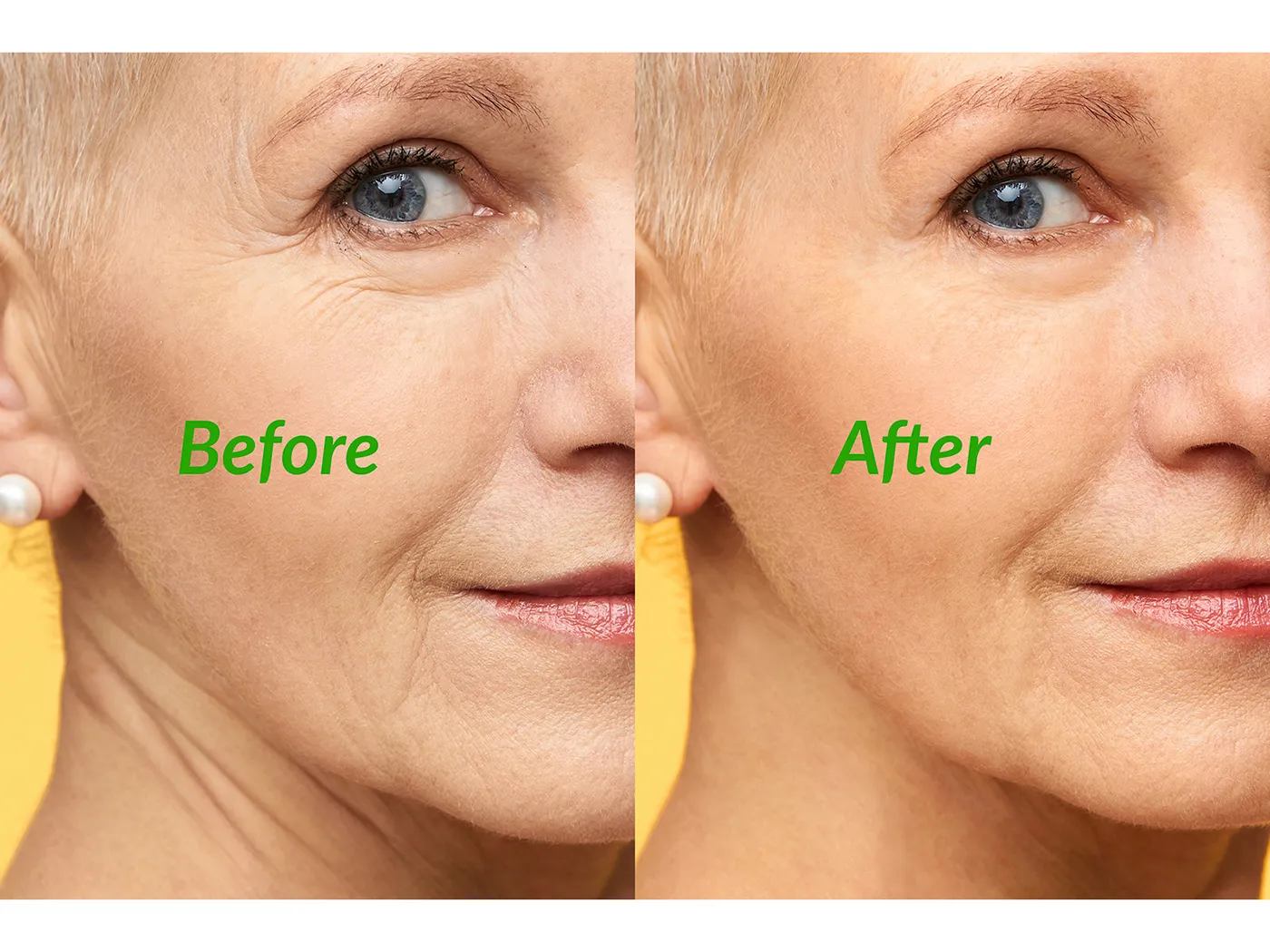 High End Retouching Remove Face Wrinkles