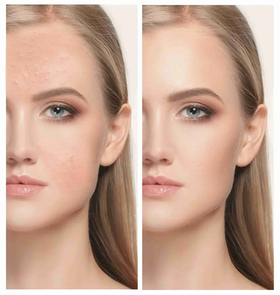 portrait retouching services uk 2